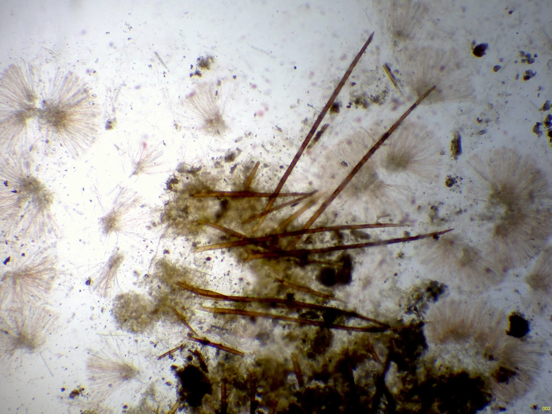 Microscopía de Scutellinia pilatii - 10 - Pelos x 40-002